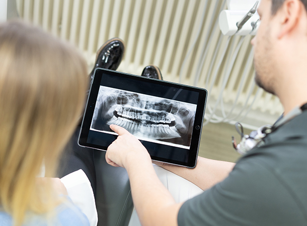 Wurzelbehandlung Paderborn: für den Erhalt Ihrer Zähne